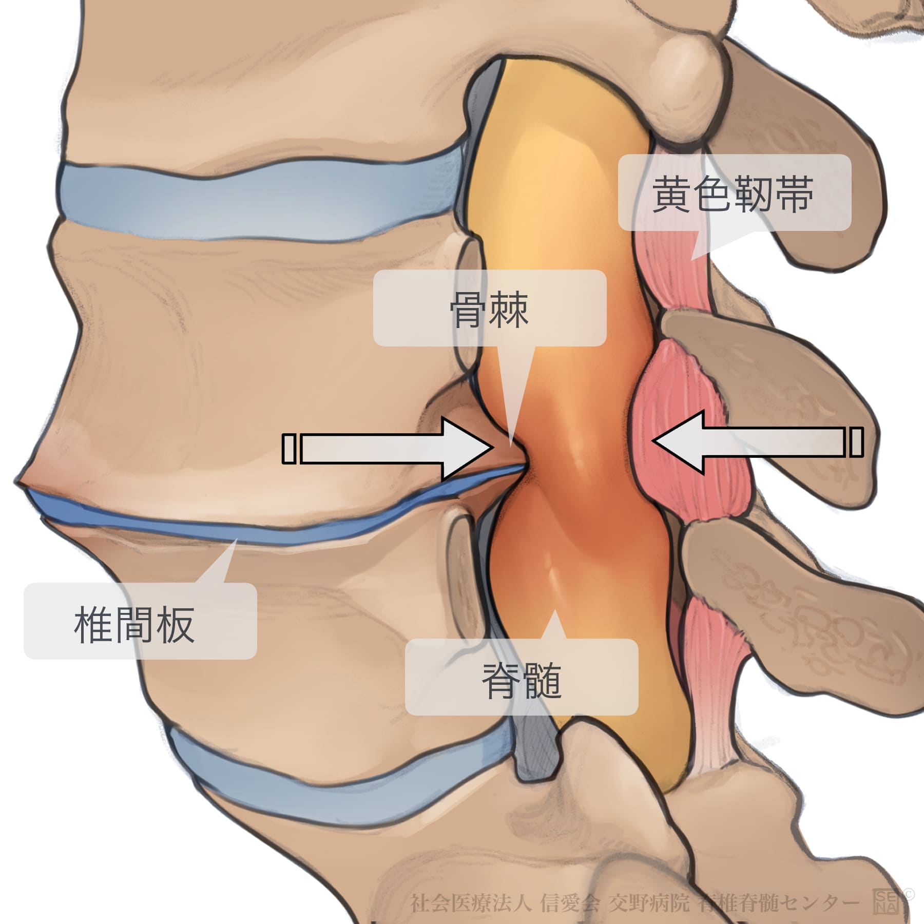 多摩市・多摩センターで腰部脊柱管狭窄症による腰痛・脚のしびれでお悩みの方